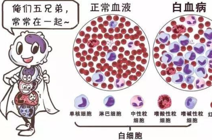 白血病的早期症状和前兆