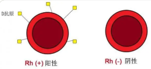 熊猫血是什么血型